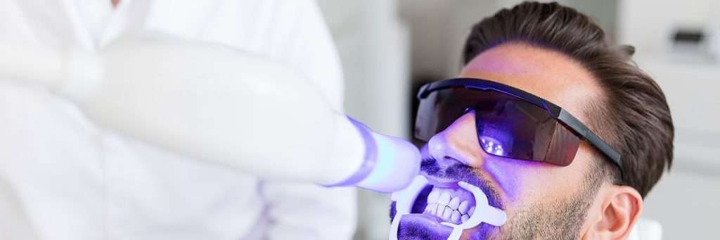 how-to-choose-a-teeth-whitening-machine